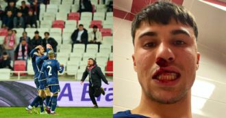 Copertina di Paura in Turchia, Fiorentina aggredita: i tifosi invadono il campo, rotto il naso a Bianco