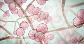 Copertina di Candida Auris, il super-fungo resistente ai farmaci: un caso accertato in Toscana