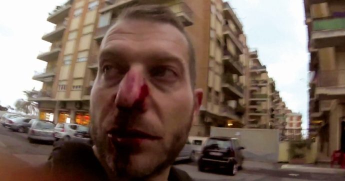 Aggressione e testata: c’è un’altra condanna