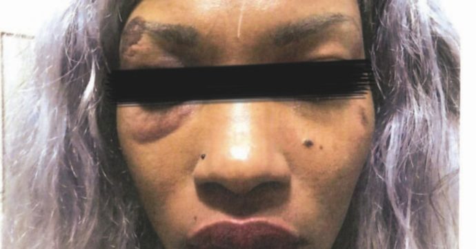 Bologna, botte in questura: gip chiede indagine su due poliziotti