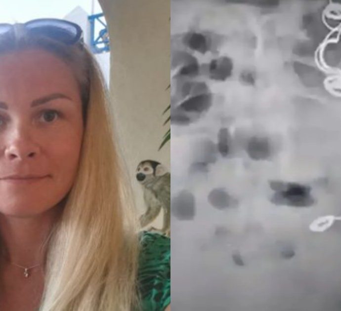 Per undici anni soffre di atroci dolori, poi la scoperta choc: i medici si erano dimenticati ago e filo nel suo utero durante un’operazione