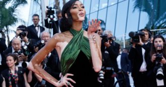 Copertina di Vitiligine, dietro alle differenze di colore della pelle si cela una patologia autoimmune cronica (con importanti conseguenze psicologiche)