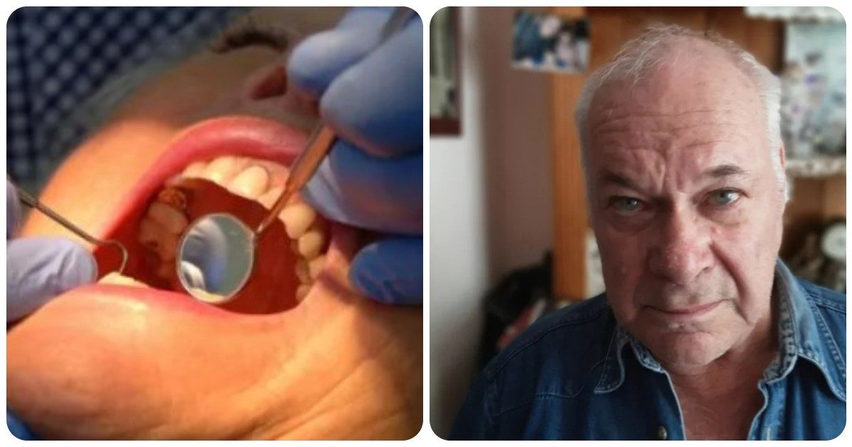 72enne non riesce a prendere appuntamento dal dentista, disperato si strappa da solo il dente con le dita