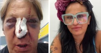 Copertina di Parla il giornalista aggredito all’evento con Rita De Crescenzo: “Svenuto in una pozza di sangue”. Le parole di Antonello Lai