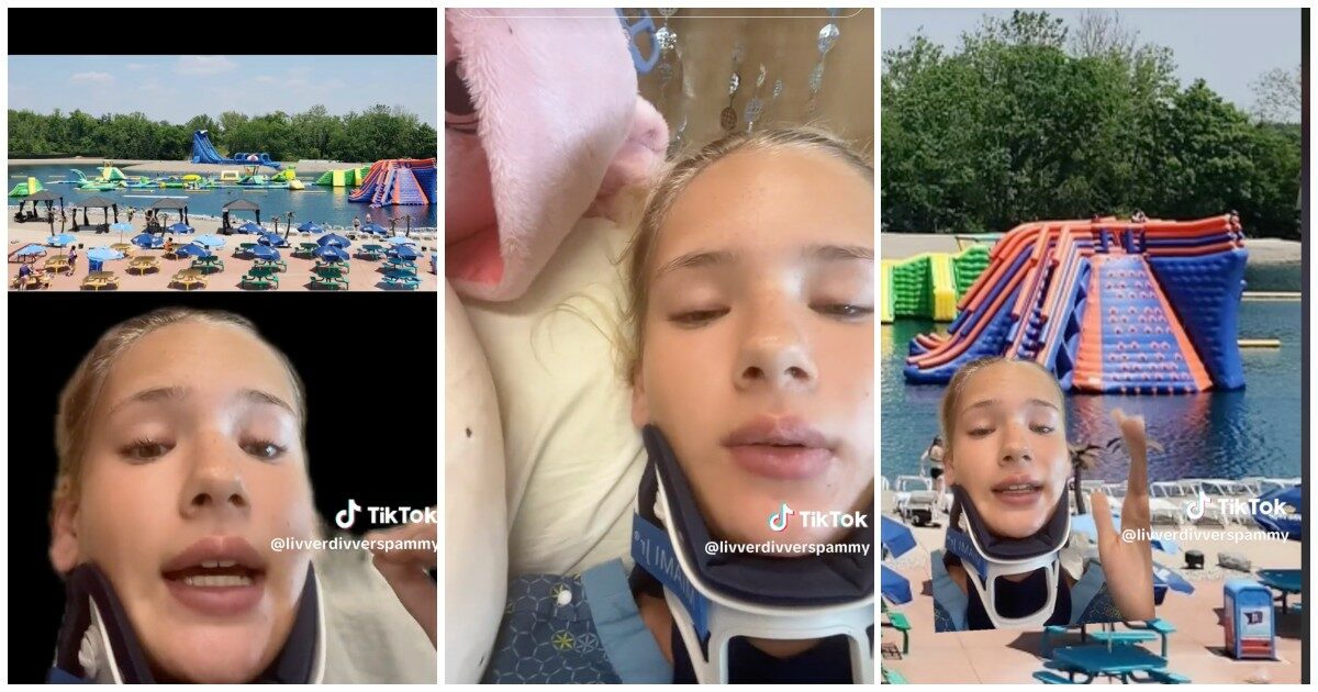 Cade dal gonfiabile al parco acquatico, si frattura la spina dorsale e resta momentaneamente paralizzata: “Un miracolo che posso ancora camminare”