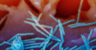 Copertina di Virus sinciziale (Rsv), l’Ema raccomanda il via libera al vaccino per neonati e over 60