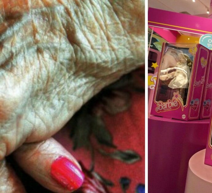 Doll therapy con Barbie in una Rsa per le pazienti affette da Alzheimer