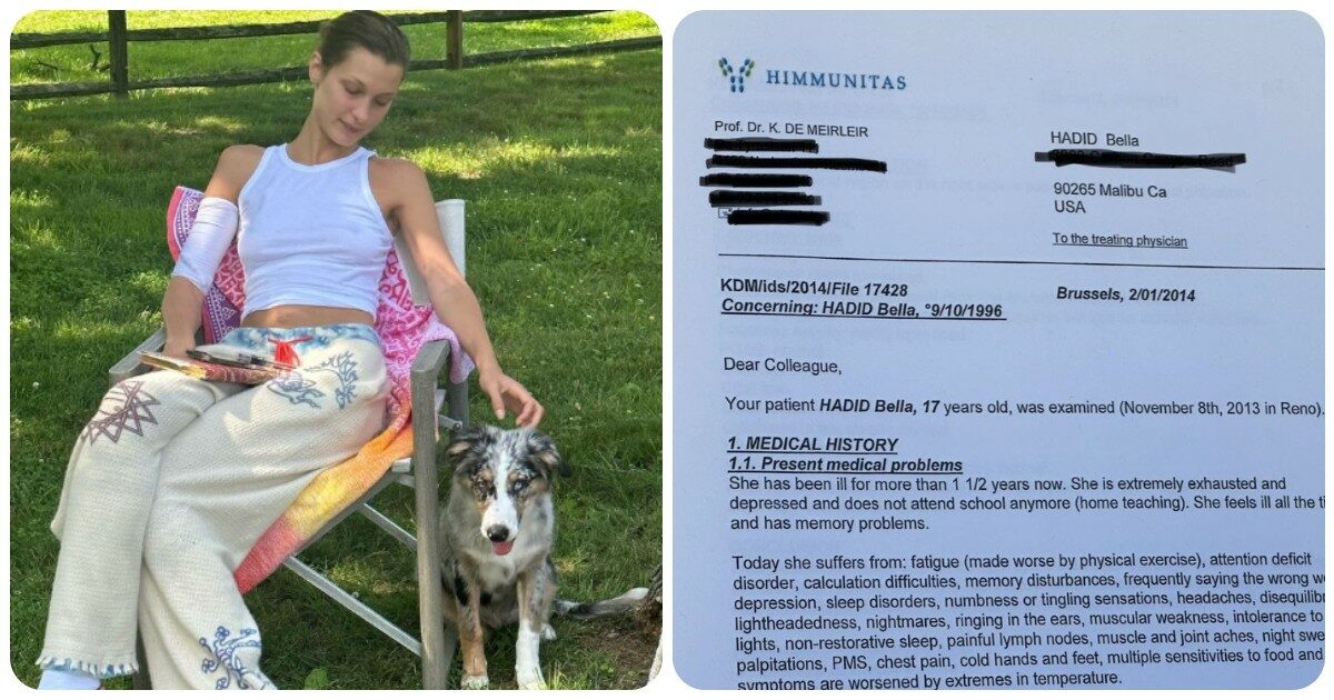 Bella Hadid termina le cure per la malattia di Lyme e annuncia: “Sto bene, tornerò quando sarò pronta”