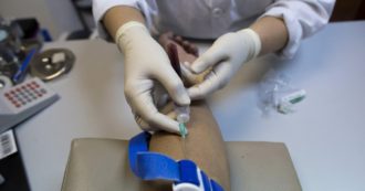 Copertina di Hiv “vittima” collaterale Covid. Troppe diagnosi arrivano tardi