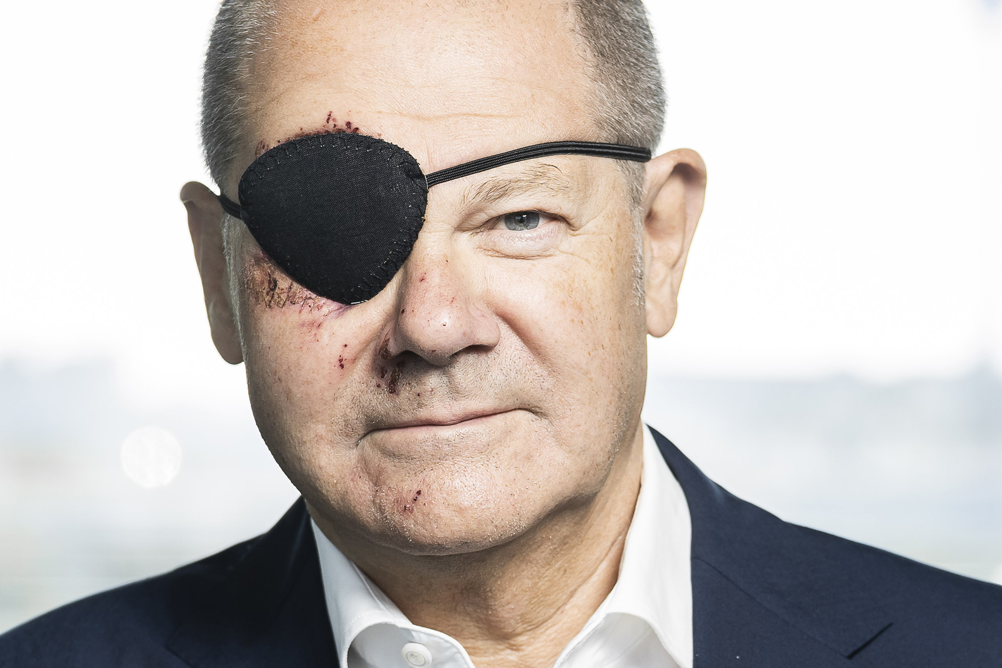 Olaf Scholz posta una foto con una benda sull'occhio dopo una caduta  facendo jogging: Aspetto di vedere i meme - Il Fatto Quotidiano