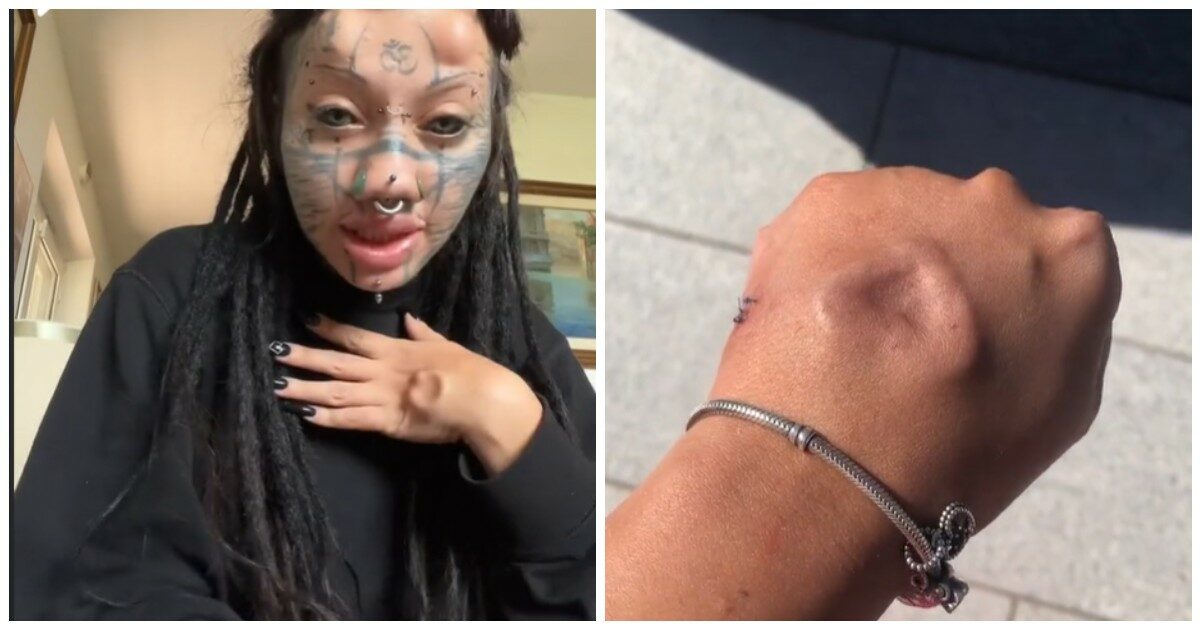 Chiara Dell’Abate, la tiktoker che vuole trasformarsi in gatto: “Ho quattro corna e i capezzoli rimossi”