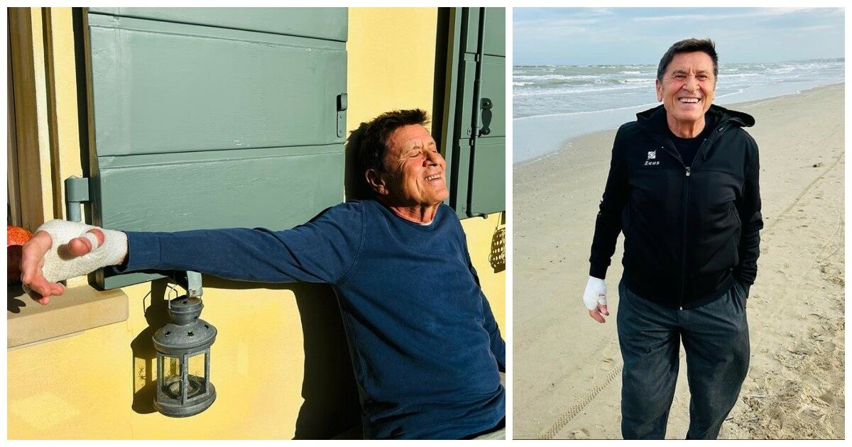 Gianni Morandi torna sui social ma le foto con la mano fasciata preoccupano i fan: “Cosa è successo? Come stai?”. Lui risponde così