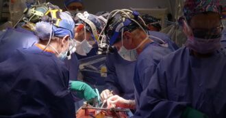 Copertina di Trapianti, morto il secondo paziente che aveva ricevuto il cuore di un maiale geneticamente modificato