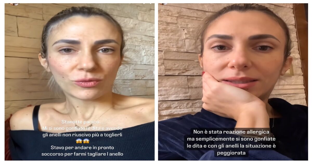 Melory Blasi, il racconto choc della sorella di Ilary: “Gli anelli non uscivano, il dito era violaceo e stava andando in cancrena”