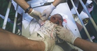 Copertina di Gaza, il primario di al Shifa: “3 bimbi morti, altri 36 senza speranza”