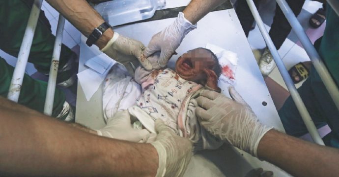 Gaza, il primario di al Shifa: “3 bimbi morti, altri 36 senza speranza”