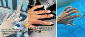 Copertina di Si fa un tatuaggio all’henné sulle dita ma ha una reazione allergica: “Prima il prurito, poi mi si è paralizzata tutta la mano”