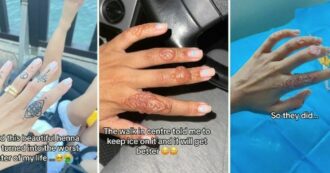 Copertina di Si fa un tatuaggio all’henné sulle dita ma ha una reazione allergica: “Prima il prurito, poi mi si è paralizzata tutta la mano”