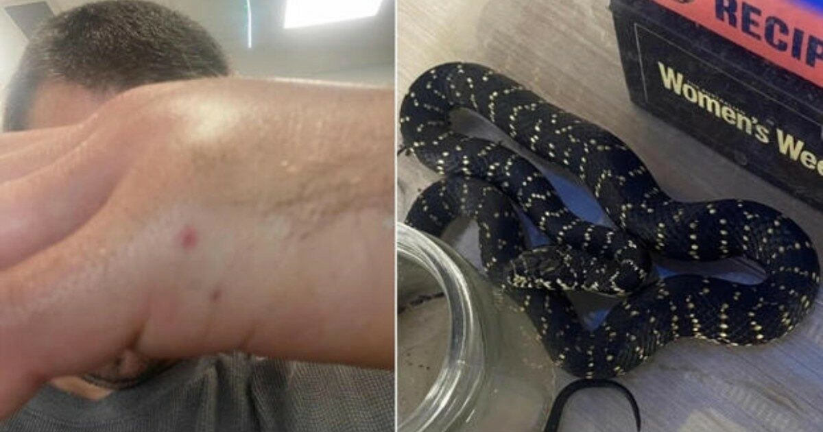 Papà porta a casa un serpente per farlo vedere ai figli ma non sa che è velenoso: il rettile lo morde e l’uomo finisce in ospedale