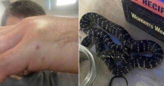 Copertina di Papà porta a casa un serpente per farlo vedere ai figli ma non sa che è velenoso: il rettile lo morde e l’uomo finisce in ospedale