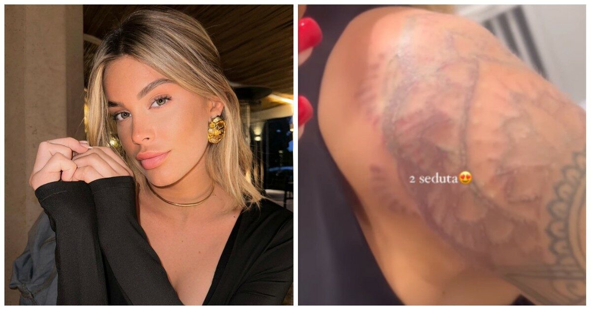 Sophie Codegoni rimuove il tatuaggio sulla spalla: “Un male incredibile. Mi viene da piangere solo al pensiero”