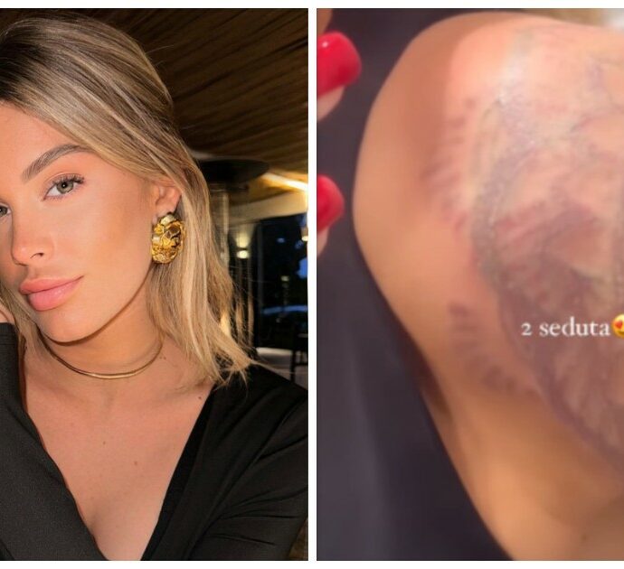 Sophie Codegoni rimuove il tatuaggio sulla spalla: “Un male incredibile. Mi viene da piangere solo al pensiero”