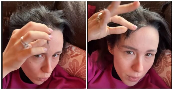 “Dopo il parto pensavo di diventare pelata”: Aurora Ramazzotti mostra la perdita dei capelli dopo la gravidanza