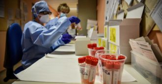 La peste polmonare fa una vittima in Arizona, primo caso dal 2007. Come si trasmette