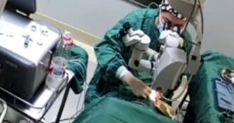 Copertina di Choc in sala operatoria: il chirurgo prende a pugni la paziente di 82 anni che sta operando agli occhi – VIDEO