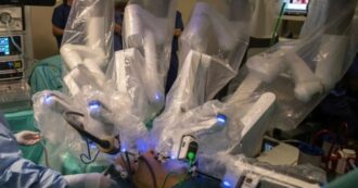 Copertina di Robot chirurgico brucia l’intestino della paziente malata di tumore: avrebbe dovuto avere una “precisione oltre i limiti della mano umana”