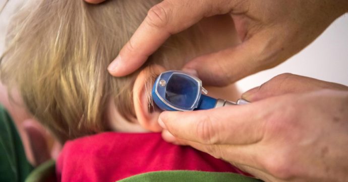Morbillo, identificata  in Italia nuova variante