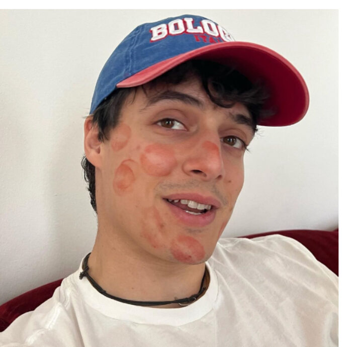 Muschio Selvaggio, Fedez rivela: “La penultima puntata ci è costata una diffida. Ecco di cosa parliamo”. E Luis Sal potrebbe tornare con il podcast