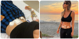 Copertina di “Ho scoperto per caso di avere un tumore e sono stata operata d’urgenza”, la storia della disc jockey Deborah De Luca