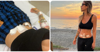 Copertina di “Ho scoperto per caso di avere un tumore e sono stata operata d’urgenza”, la storia della disc jockey Deborah De Luca