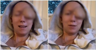 Copertina di A 28 anni scopre di avere un tumore al naso: i medici le asportano un occhio e lo sostituiscono con un pezzo di coscia. Su TikTok il racconto del suo calvario