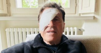 Copertina di Cosa è successo a Gianni Morandi? La foto con l’occhio bendato spaventa i fan: “Ho fatto a pugni…”