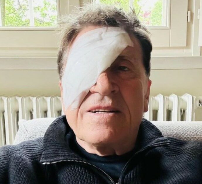 Cosa è successo a Gianni Morandi? La foto con l’occhio bendato spaventa i fan: “Ho fatto a pugni…”