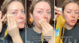 Copertina di Ecco perché su TikTok si spalmano la buccia di banana sulla faccia