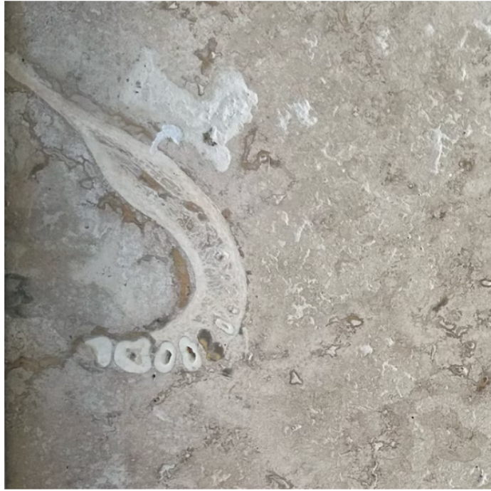 Dentista trova una “mandibola umana” nella piastrella del pavimento, la scoperta choc: “Mi sembrava molto familiare la forma”
