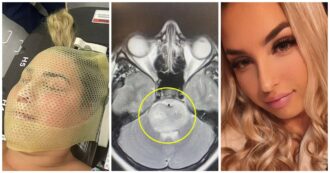 Copertina di “Mi sentivo ‘fuori di testa’: pensavo fosse una sbornia, invece era un tumore al cervello”: 18enne riceve la diagnosi choc dopo una vacanza in Grecia con gli amici