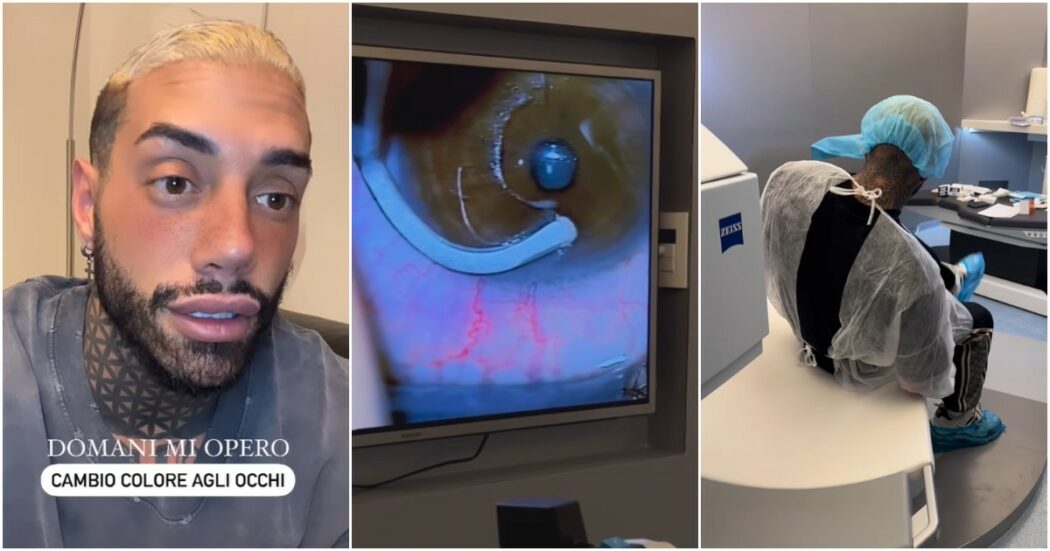 Lo sfogo di Francesco Chiofalo: “Dopo l’operazione agli occhi ho ricevuto pesanti insulti, nessuno ha il diritto di farlo”