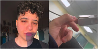 Copertina di “Molestata da un infermiere in ambulanza. Esperienza viscida e schifosa”. La denuncia di Chiara Viscioni, la Asl ha avviato subito un’indagine interna