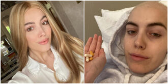 Copertina di I medici prescrivono a una sportiva “riposo e ibuprofene” per il dolore alla spalla, ma era un tumore grande quanto un avocado