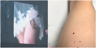 Copertina di “C’è un pipistrello sulla mia gamba. Qualcuno può aiutarmi?”. Taylor Momsen morsa durante un concerto