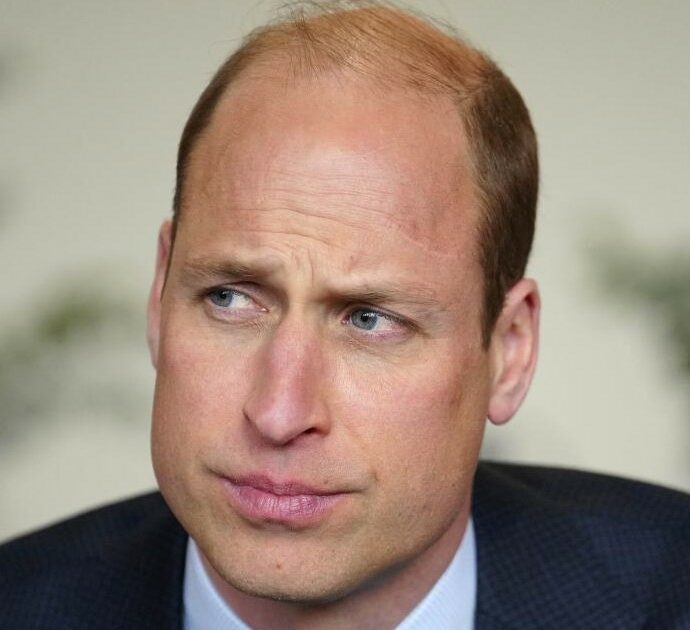 Perché il principe William ha la cicatrice “alla Harry Potter” sulla tempia? Ecco svelato il mistero dell’incidente