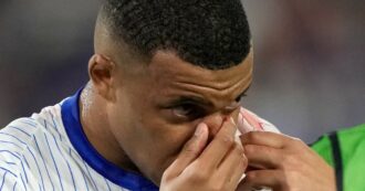 Copertina di Euro 2024, la Francia trema: Kylian Mbappé si è rotto il naso. Le sue condizioni e quando può tornare in campo