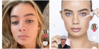 Copertina di “Garance Authié ha una deviazione mandibolare”: la modella smentisce il dottor Gardellin e per la prima volta conferma la relazione con Fedez