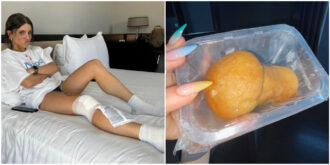 Copertina di Angelina Mango scivola sulle scale e si fa male: “Ho avuto paura di rompermi tutto. Per salvare i miei babà ho sacrificato il ginocchio”