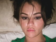 Copertina di “Faccio il botox e sinceramente detesto tutto questo. Lasciatemi in pace”: la risposta di Selena Gomez agli haters