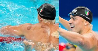 Copertina di Macchie nere sulla schiena di Martinenghi alle Olimpiadi: cos’è la coppettazione, “terapia antidolorifica” utilizzata nel nuoto